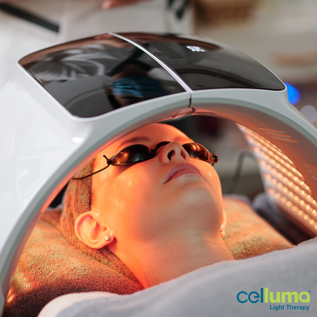 CELLUMA LIGHT THERAPY - 1 MONTH PACKAGE ( 8 TREATMENT SESSIONS)